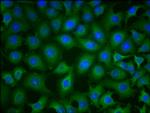 PKM Monoclonal Antibody (6C3C7)