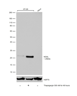 NGAL Antibody