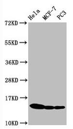Phospho-Histone H3 (Ser10) Antibody in Western Blot (WB)