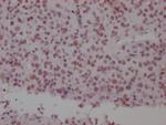 SMC1 Antibody in Immunohistochemistry (Paraffin) (IHC (P))