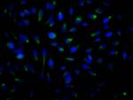 ROCK2 Recombinant Rabbit Monoclonal Antibody (10E1)