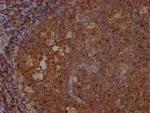 SHIP1 Recombinant Rabbit Monoclonal Antibody (9G11)