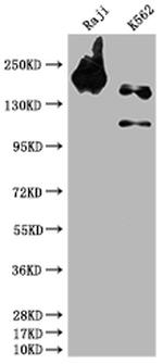SHIP1 Antibody in Western Blot (WB)