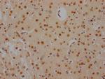 FUBP1 Antibody in Immunohistochemistry (Paraffin) (IHC (P))