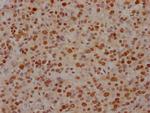 FUBP1 Antibody in Immunohistochemistry (Paraffin) (IHC (P))