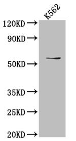 UAP1 Recombinant Rabbit Monoclonal Antibody (1F2)