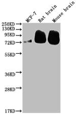 BACE1 Recombinant Rabbit Monoclonal Antibody (7G3)