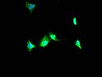 VCP Recombinant Rabbit Monoclonal Antibody (5H12)