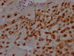 GATA3 Antibody in Immunohistochemistry (Paraffin) (IHC (P))