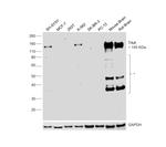 TrkA Recombinant Rabbit Monoclonal Antibody (2A5)