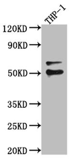 FLI1 Recombinant Rabbit Monoclonal Antibody (4E5)