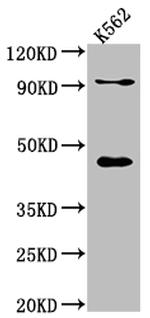 PCYT1A Antibody in Western Blot (WB)