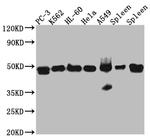 Arp3 Recombinant Rabbit Monoclonal Antibody (7E5)