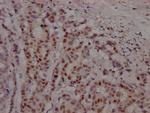 Androgen Receptor Antibody in Immunohistochemistry (Paraffin) (IHC (P))