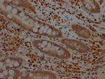 MEK1 Recombinant Rabbit Monoclonal Antibody (3F10)