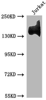 ITGA4 Recombinant Rabbit Monoclonal Antibody (1H4)
