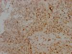Aurora B Recombinant Rabbit Monoclonal Antibody (4E5)