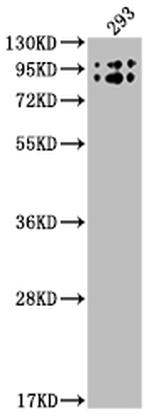 Butyrylcholinesterase Recombinant Rabbit Monoclonal Antibody (1E9)