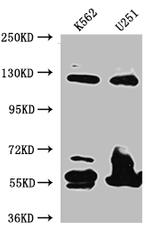 BUBR1 Recombinant Rabbit Monoclonal Antibody (7H4)