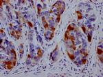 DHFR Antibody in Immunohistochemistry (Paraffin) (IHC (P))