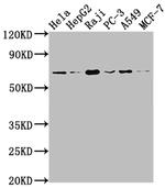 ALAS1 Recombinant Rabbit Monoclonal Antibody (2A9)