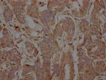 PTP1B Recombinant Rabbit Monoclonal Antibody (1G3)