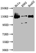 Bub1 Recombinant Rabbit Monoclonal Antibody (9C11)