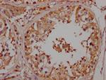 NGF Recombinant Rabbit Monoclonal Antibody (5F10)