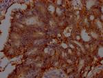 EpCAM Antibody in Immunohistochemistry (Paraffin) (IHC (P))