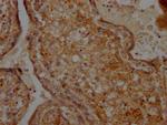 CD266 Recombinant Rabbit Monoclonal Antibody (7H8)