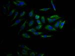 CYP17A1 Recombinant Rabbit Monoclonal Antibody (5A9)