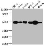 TACR1 Recombinant Rabbit Monoclonal Antibody (1E5)