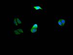 PIK3CA Recombinant Rabbit Monoclonal Antibody (10E5)