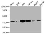 Thymidylate Synthase Recombinant Rabbit Monoclonal Antibody (2B2)