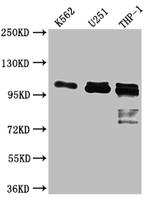 ITCH Recombinant Rabbit Monoclonal Antibody (9C3)