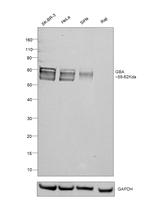 GBA Antibody