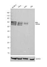 GBA Antibody in Western Blot (WB)