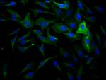 Dynamin 2 Recombinant Rabbit Monoclonal Antibody (1D8)