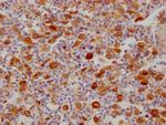 FDFT1 Antibody in Immunohistochemistry (Paraffin) (IHC (P))