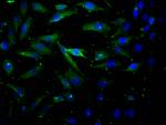 AKT1 Antibody in Immunocytochemistry (ICC/IF)
