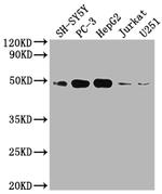 S1P1 Recombinant Rabbit Monoclonal Antibody (4F2)