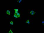 eIF5A Antibody in Immunocytochemistry (ICC/IF)