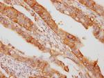 eIF5A Antibody in Immunohistochemistry (Paraffin) (IHC (P))