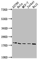 eIF5A Antibody in Western Blot (WB)