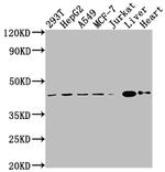 AGTR2 Recombinant Rabbit Monoclonal Antibody (6C7)