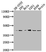 OPRD1 Recombinant Rabbit Monoclonal Antibody (7G7)