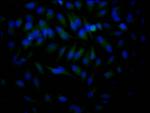 HDAC2 Recombinant Rabbit Monoclonal Antibody (9H4)