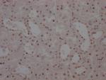 WT1 Recombinant Rabbit Monoclonal Antibody (5F2)