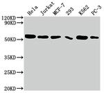 Cdc37 Recombinant Rabbit Monoclonal Antibody (10C3)