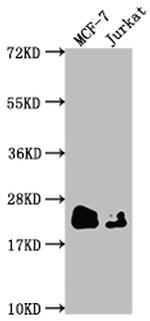 MGMT Antibody in Western Blot (WB)